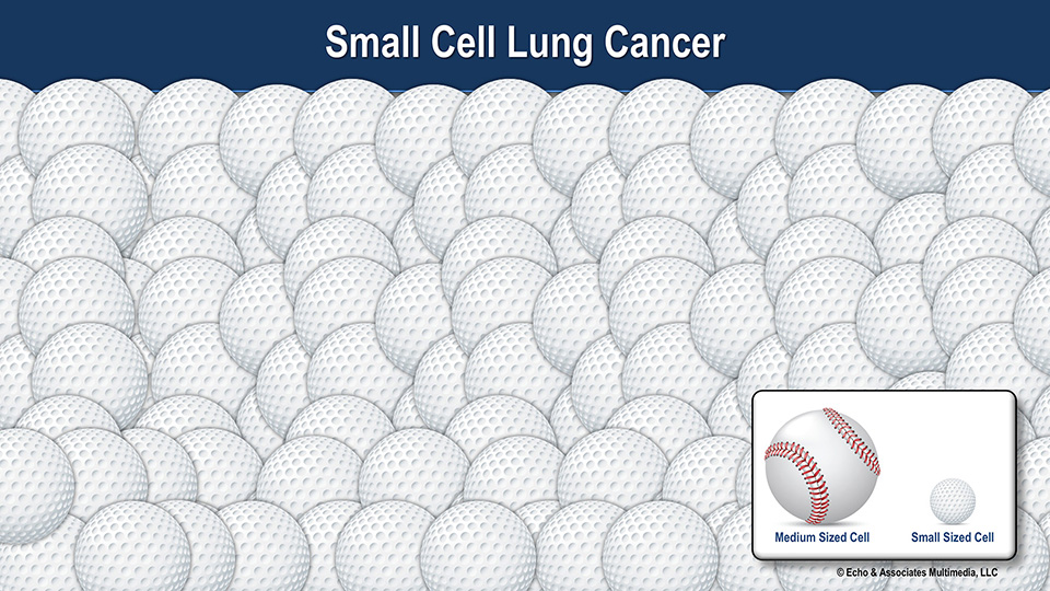 Small Cell Lung Cancer
